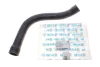 Патрубок радіатора (верхній) BMW 3 (E36) 1.6-1.8 i 93-00 319 115 3204 MEYLE 319-115-3204 (фото 2)